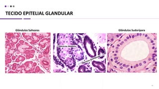 TECIDO EPITELIAL GLANDULAR
34
Glândulas Salivares Glândulas Sudorípara
 