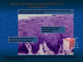Epitélio pavimentoso estratificado NÃO queratinizado Células da camada basal possuem forma cúbica Células da camada intermediária são polimorfas Células da superfície (pavimentosas ou escamosas) são achatadas, nucleadas As mucosas geralmente são umedecidas, revestem a boca, a orofaringe, o esôfago e a vagina.  