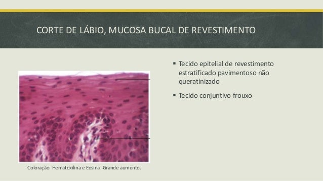 Tecido epitelial de revestimento pdf