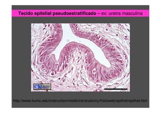 Tecido epitelial pseudoestratificado – ex: uretra masculina
http://www.kumc.edu/instruction/medicine/anatomy/histoweb/epithel/epithel.htm
 