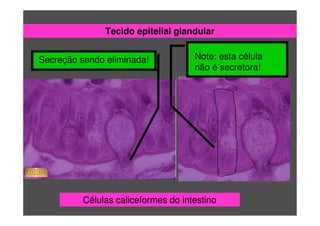 Tecido epitelial glandular
Células caliceformes do intestino
Secreção sendo eliminada! Note: esta célula
não é secretora!
 