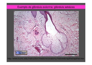 Exemplo de glândula exócrina: glândula sebácea
http://www.kumc.edu/instruction/medicine/anatomy/histoweb/epithel/epithel.htm
 