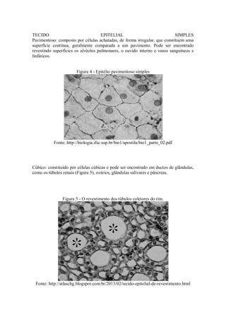 TECIDO EPITELIAL SIMPLES
Pavimentoso: composto por células achatadas, de forma irregular, que constituem uma
superfície contínua, geralmente comparada a um pavimento. Pode ser encontrado
revestindo superfícies os alvéolos pulmonares, o ouvido interno e vasos sanguíneos e
linfáticos.
Figura 4 - Epitélio pavimentoso simples
Fonte: http://biologia.ifsc.usp.br/bio1/apostila/bio1_parte_02.pdf
Cúbico: constituído por células cúbicas e pode ser encontrado em ductos de glândulas,
como os túbulos renais (Figura 5), ovários, glândulas salivares e pâncreas.
Figura 5 - O revestimento dos túbulos coletores do rim.
Fonte: http://atlaschg.blogspot.com.br/2013/02/tecido-epitelial-de-revestimento.html
 