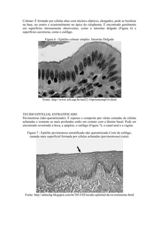 Colunar: É formado por células altas com núcleos elípticos, alongados, pode se localizar
na base, no centro e ocasionalmente no ápice do citoplasma. É encontrado geralmente
em superfícies intensamente absorventes, como o intestino delgado (Figura 6) e
superfícies secretoras, como o esôfago.
Figura 6 - Epitélio colunar simples. Intestino Delgado
Fonte: http://www.icb.usp.br/mol/2-16prismsimpl16.html
TECIDO EPITELIAL ESTRATIFICADO
Pavimentoso (não-queratinizado): É espesso e composto por várias camadas de células
achatadas e somente as mais profundas estão em contato com a lâmina basal. Pode ser
encontrado revestindo a boca, a epiglote, o esôfago (Figura 7), o canal anal e a vagina.
Figura 7 - Epitélio pavimentoso estratificado não queratinizado.Corte de esôfago,
camada mais superficial formada por células achatadas (pavimentosas) (seta).
Fonte: http://atlaschg.blogspot.com.br/2013/02/tecido-epitelial-de-revestimento.html
 