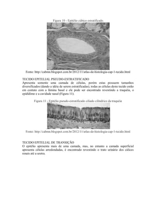 Figura 10 - Epitélio cúbico estratificado.
Fonte: http://cabmn.blogspot.com.br/2012/11/atlas-de-histologia-cap-1-tecido.html
TECIDO EPITELIAL PSEUDO-ESTRATIFICADO
Apresenta somente uma camada de células, porém estas possuem tamanhos
diversificados (dando a idéia de serem estratificadas), todas as células deste tecido estão
em contato com a lâmina basal e ele pode ser encontrado revestindo a traquéia, o
epidídimo e a cavidade nasal (Figura 11).
Figura 11 - Epitélio pseudo-estratificado ciliado cilíndrico da traquéia
.
Fonte: http://cabmn.blogspot.com.br/2012/11/atlas-de-histologia-cap-1-tecido.html
TECIDO EPITELIAL DE TRANSIÇÃO
O epitélio apresenta mais de uma camada, mas, no entanto a camada superficial
apresenta células arredondadas, é encontrado revestindo o trato urinário dos cálices
renais até a uretra.
 