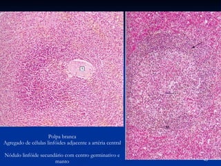 Polpa branca Agregado de células linfóides adjacente a artéria central Nódulo linfóide secundário com centro germinativo e manto 