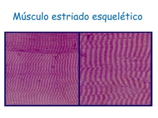 Músculo estriado esquelético
 