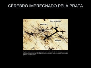 CÉREBRO IMPREGNADO PELA PRATA
 