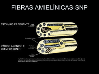 FIBRAS AMIELÍNICAS-SNP

TIPO MAIS FREQUENTE




VÁRIOS AXÔNIOS E
UM MESAXÔNIO
 