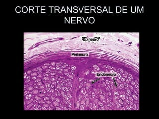 CORTE TRANSVERSAL DE UM
         NERVO
 
