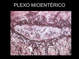 PLEXO MIOENTÉRICO
 