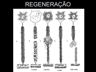 REGENERAÇÃO
 