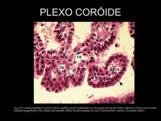 PLEXO CORÓIDE
 
