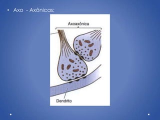 • Axo - Axônicas;
 