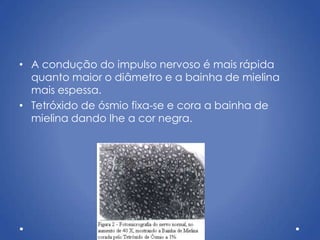 • A condução do impulso nervoso é mais rápida
quanto maior o diâmetro e a bainha de mielina
mais espessa.
• Tetróxido de ósmio fixa-se e cora a bainha de
mielina dando lhe a cor negra.
 