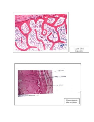 Tecido Ósseo
(esponjoso
calcificado)

Osso compacto
descalcificado

 