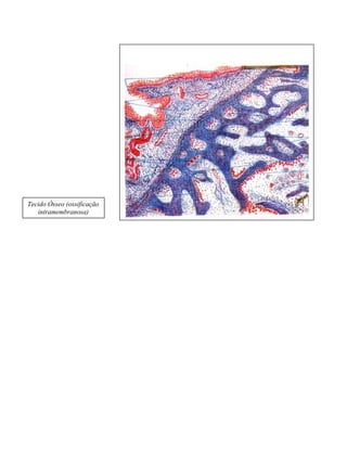 Tecido Ósseo (ossificação
intramembranosa)

 