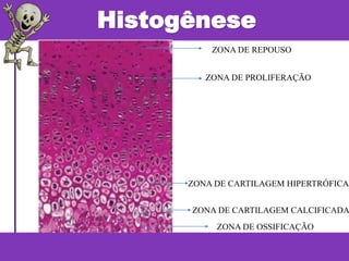 Histogênese
ZONA DE REPOUSO
ZONA DE PROLIFERAÇÃO
ZONA DE CARTILAGEM HIPERTRÓFICA
ZONA DE CARTILAGEM CALCIFICADA
ZONA DE OSSIFICAÇÃO
 