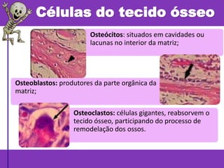 Células do tecido ósseo
Osteócitos: situados em cavidades ou
lacunas no interior da matriz;
Osteoblastos: produtores da parte orgânica da
matriz;
Osteoclastos: células gigantes, reabsorvem o
tecido ósseo, participando do processo de
remodelação dos ossos.
 