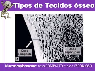 Tipos de Tecidos ósseo
Macroscopicamente: osso COMPACTO e osso ESPONJOSO
 