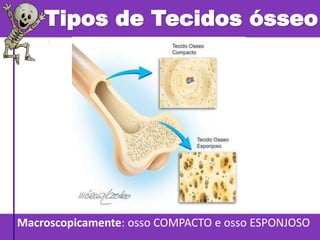 Tipos de Tecidos ósseo
Macroscopicamente: osso COMPACTO e osso ESPONJOSO
 