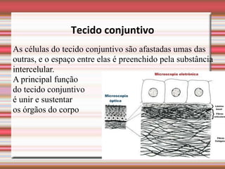 Tecido conjuntivo
As células do tecido conjuntivo são afastadas umas das
outras, e o espaço entre elas é preenchido pela substância
intercelular.
A principal função
do tecido conjuntivo
é unir e sustentar
os órgãos do corpo
 