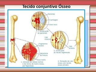 Tecido conjuntivo Ósseo
 