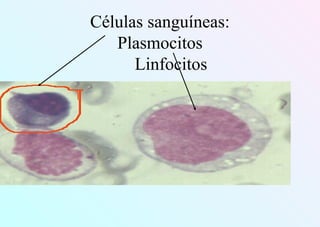 Células sanguíneas:
Plasmocitos
Linfocitos
 