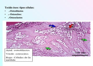Tecido óseo: tipos células:
• .-Osteoblastos
• .- Osteocitos:
• .-Osteoclastos
 