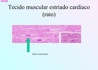 Tecido muscular estriado cardíaco
(rato)
Discos intercalares
 