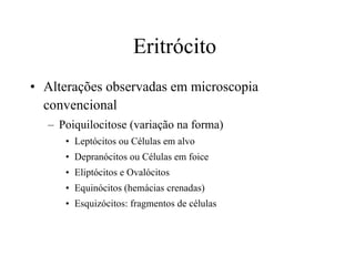 Eritrócito  Alterações observadas em microscopia convencional Poiquilocitose (variação na forma) Leptócitos ou Células em alvo Depranócitos ou Células em foice Eliptócitos e Ovalócitos Equinócitos (hemácias crenadas) Esquizócitos: fragmentos de células 