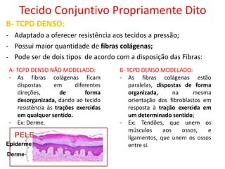Tecido Conjuntivo Propriamente Dito
B- TCPD DENSO:
- Adaptado a oferecer resistência aos tecidos a pressão;
- Possui maior quantidade de fibras colágenas;
- Pode ser de dois tipos de acordo com a disposição das Fibras:
B- TCPD DENSO MODELADO:
- As fibras colágenas estão
paralelas, dispostas de forma
organizada, na mesma
orientação dos fibroblastos em
resposta à tração exercida em
um determinado sentido;
- Ex: Tendões, que unem os
músculos aos ossos, e
ligamentos, que unem os ossos
entre si.
A- TCPD DENSO NÃO MODELADO:
- As fibras colágenas ficam
dispostas em diferentes
direções, de forma
desorganizada, dando ao tecido
resistência às trações exercidas
em qualquer sentido.
- Ex: Derme.
PELE
Epiderme
Derme
 
