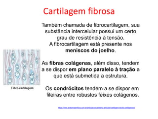 Também chamada de fibrocartilagem, sua
substância intercelular possui um certo
grau de resistência à tensão.
A fibrocartilagem está presente nos
meniscos do joelho.
As fibras colágenas, além disso, tendem
a se dispor em plano paralelo à tração a
que está submetida a estrutura.
Os condrócitos tendem a se dispor em
fileiras entre robustos feixes colágenos.
https://www.anatomiaemfoco.com.br/articulacoes-sistema-articular/cartilagem-tecido-cartilaginoso/
Cartilagem fibrosa
 