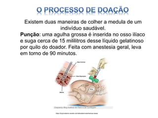 Existem duas maneiras de colher a medula de um
indivíduo saudável.
Punção: uma agulha grossa é inserida no osso ilíaco
e suga cerca de 15 mililitros desse líquido gelatinoso
por quilo do doador. Feita com anestesia geral, leva
em torno de 90 minutos.
https://tccjornalismo.wixsite.com/atitudeemvida/medula-ossea
 