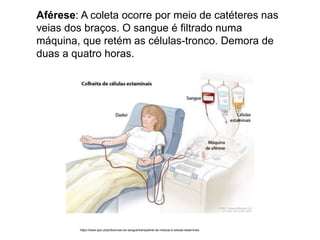 Aférese: A coleta ocorre por meio de catéteres nas
veias dos braços. O sangue é filtrado numa
máquina, que retém as células-tronco. Demora de
duas a quatro horas.
https://www.apcl.pt/pt/doencas-do-sangue/transplante-de-medula-e-celulas-estaminais
 