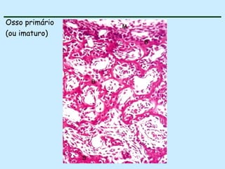 Osso primário (ou imaturo) 