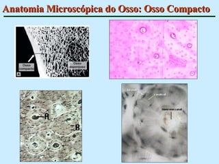 Anatomia Microscópica do Osso: Osso Compacto 