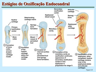 Estágios de Ossificação Endocondral Formation of bone collar around hyaline cartilage model. 1 2 3 4 Cavitation of the hyaline cartilage within the cartilage model. Invasion of internal cavities by the periosteal bud and spongy bone formation. 5 Ossification of the epiphyses; when completed, hyaline cartilage remains only in the epiphyseal plates and articular cartilages Formation of the medullary cavity as ossification continues; appearance of secondary ossification centers in the epiphyses in preparation for stage 5. Hyaline cartilage Primary ossification center Bone collar Deteriorating cartilage matrix Spongy bone formation Blood vessel of periosteal bud Secondary ossification center Epiphyseal blood vessel Medullary cavity Epiphyseal plate cartilage Spongy bone Articular cartilage Figure 6.8 