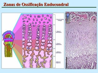 Zonas de Ossificação Endocondral 