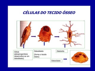CÉLULAS DO TECIDO ÓSSEO




Célula              Osteoblasto             Osteócito
osteoprogenitora    (forma o tecido
(desenvolve-se em   ósseo)
osteoblasto)
                                      Osteoclasto
 