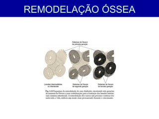 REMODELAÇÃO ÓSSEA
 