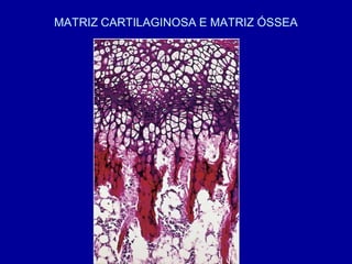 MATRIZ CARTILAGINOSA E MATRIZ ÓSSEA
 