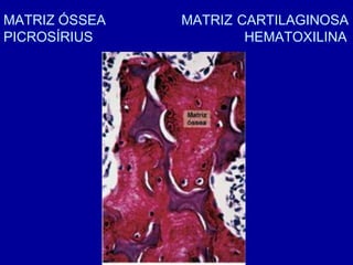 MATRIZ ÓSSEA   MATRIZ CARTILAGINOSA
PICROSÍRIUS            HEMATOXILINA
 