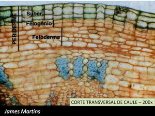 CORTE TRANSVERSAL DE CAULE – 200x
James Martins
 