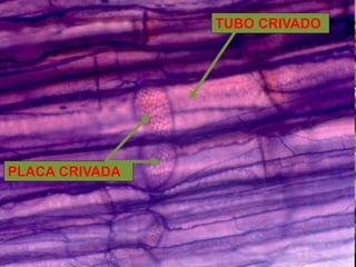 Tecidos vegetais
FLOEMA:
TUBO CRIVADO
PLACA CRIVADA
 