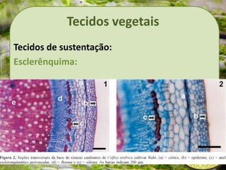Tecidos vegetais
Tecidos de sustentação:
Esclerênquima:
 