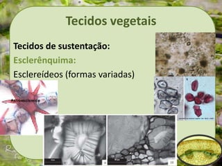 Tecidos vegetais
Tecidos de sustentação:
Esclerênquima:
Esclereídeos (formas variadas)
 