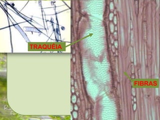 Tecidos vegetais
XILEMA:
FIBRAS
TRAQUÉIA
 