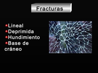 Lineal Deprimida Hundimiento Base de cráneo Fracturas  