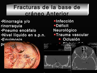Fracturas de la base de cráneo Anterior Rinorragia y/o rinorraquia Pneumo encéfalo Nivel líquido en s.p.n. Equimosis periorbiraria  Infección Déficit Neurológico Trauma vascular Oclusión Fístula CC 